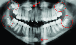 Cirurgia