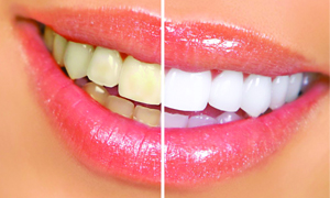 dentistica