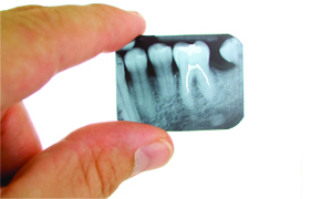 Endodontia