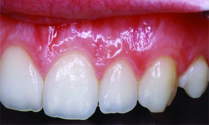 Periodontia